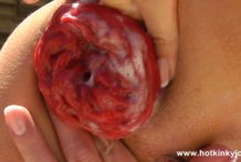 Hotkinkyjo summer brezee in anal hole, fisting & prolapse in public